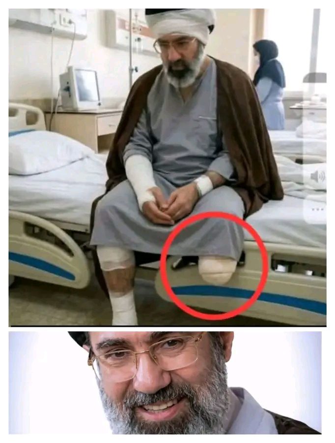 BREAKING: Viral Hospital Photo Fuels Speculation Over Mojtaba Khamenei’s Reported Injury